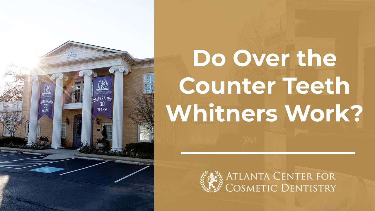 Do Over the Counter Teeth Whitners Work?