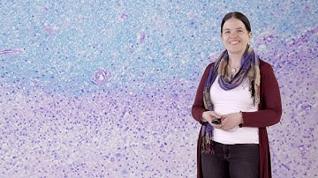 Bench to Bedside: Myelination 2 - Neuropathology of Multiple Sclerosis - Christine Stadelmann