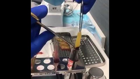 PRF box GRF Surgery instruments  prf box for rich membrin  prf process prfbox grf available