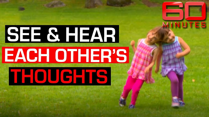Conjoined twins share taste, sight, feelings and thoughts | 60 Minutes Australia
