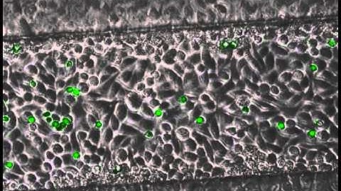 Calcium Flux via IL8 stimulation