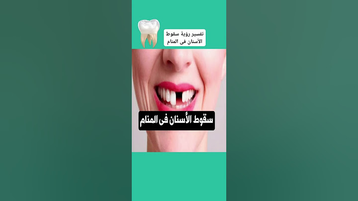 تفسير رؤية سقوط الأسنان فى المنام لابن سيرين