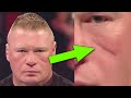 What's Wrong with Brock Lesnar's Face? 10 Surprising Things on WWE Wrestlers