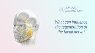 What can influence the regeneration of the facial nerve? - Bell&#39;s Palsy Knowledge Base
