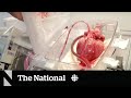 Heart transplants may soon be more accessible thanks to &#39;heart-in-a-box&#39; tech