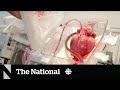 Heart transplants may soon be more accessible thanks to 'heart-in-a-box' tech