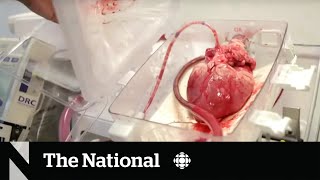 Heart transplants may soon be more accessible thanks to 'heart-in-a-box' tech