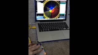 Vis 147a Project