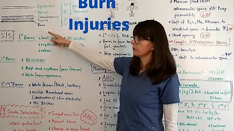 Burn Injuries