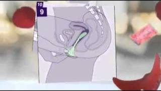 طريقة استخدام الواقي الانثوي How to Use a Female Condom.FLV