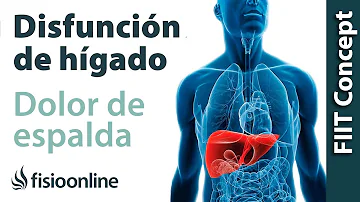 ¿Puede el hígado causar dolor de espalda?