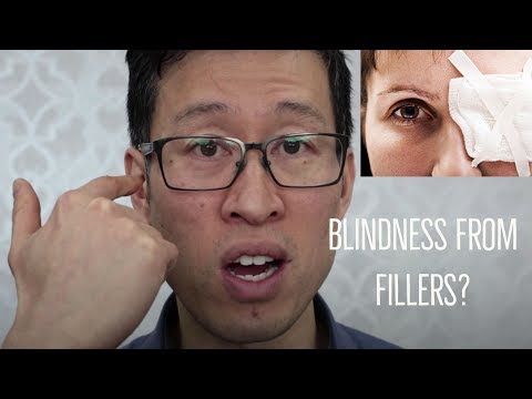 Blindness following dermal fillers? How does this happen and what can be done?