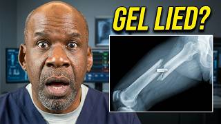 Surgeon Reacts: Garand Thumb's 5.56 Test Missed The Most Important Part!