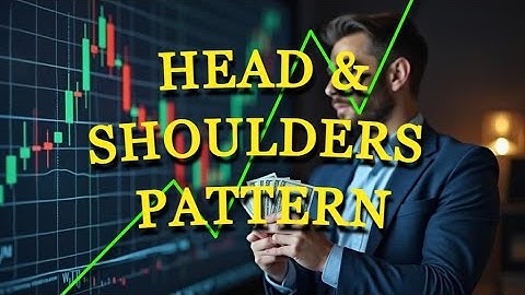STOP Trading Head & Shoulders Until You Watch This 🚨