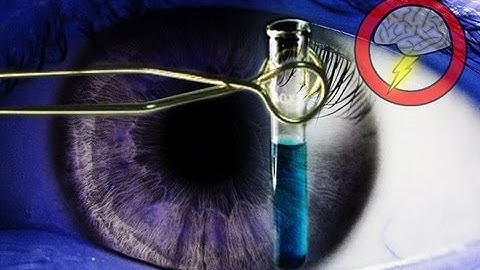 Human Eye Growing In A Lab! (Brainstorm Ep116)
