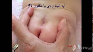 ايه البتاع دي يا دكتور ؟؟1( النغزه العجزيه )