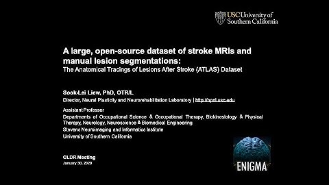 A large, open-source dataset of stroke MRIs and manual lesion segmentations