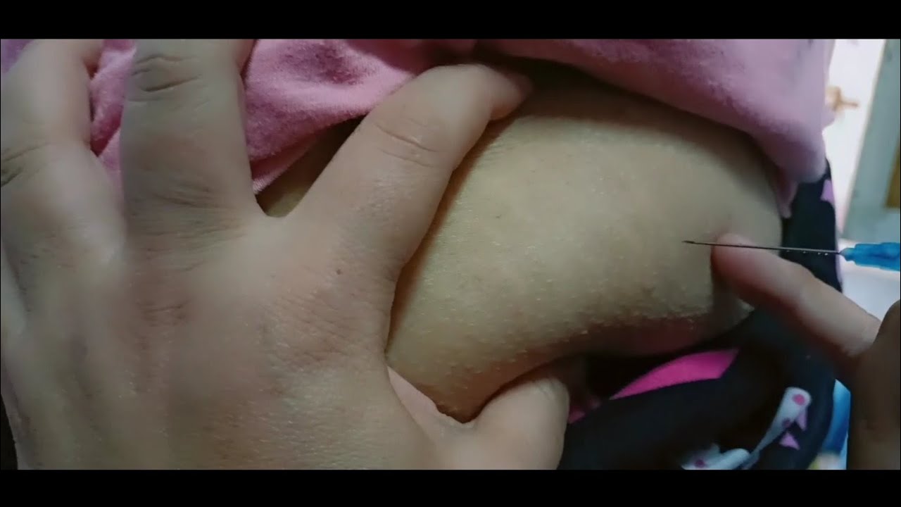 حقنه عضل 💉 في شقتي 🤗مسكن قوي جدا