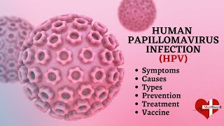 Human papillomavirus infection | HPV | What is HPV & How do you get it?