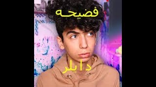طقطقه على دايلر