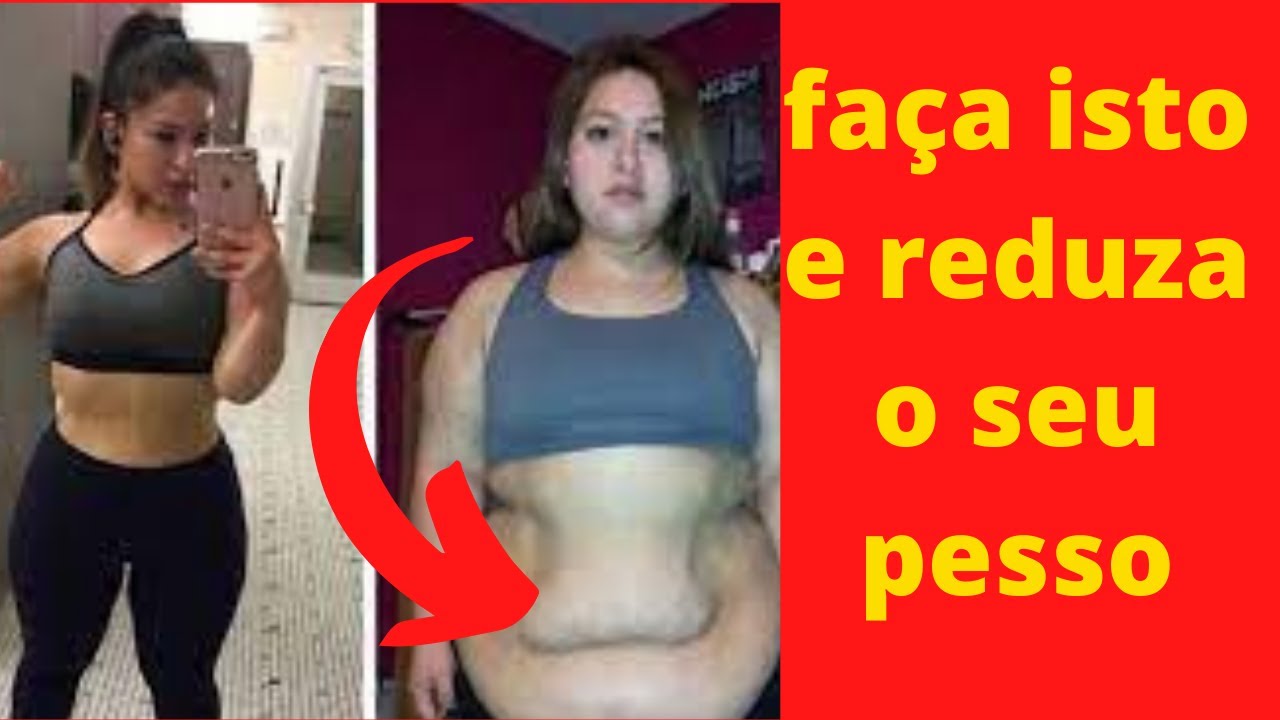 emagrecimento antes e depois reeducação alimentar