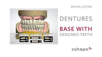 3Shape Dental System - Base with designed teeth