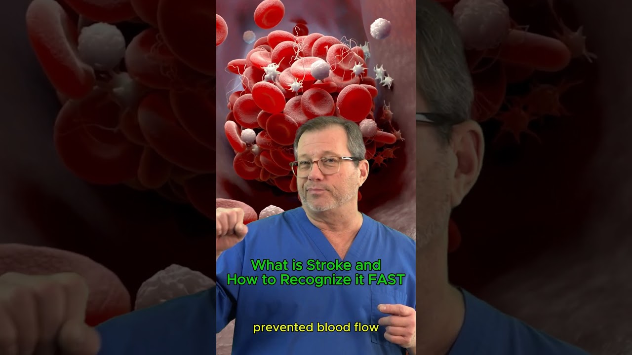 What is Stroke and How to Recognize it FAST