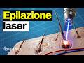 L'epilazione laser e la tecnologia che c'è dietro: come funziona sui peli e quanto è efficace