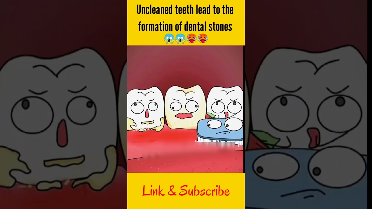 Uncleaned teeth lead to the formation of dental stones asmr shorts