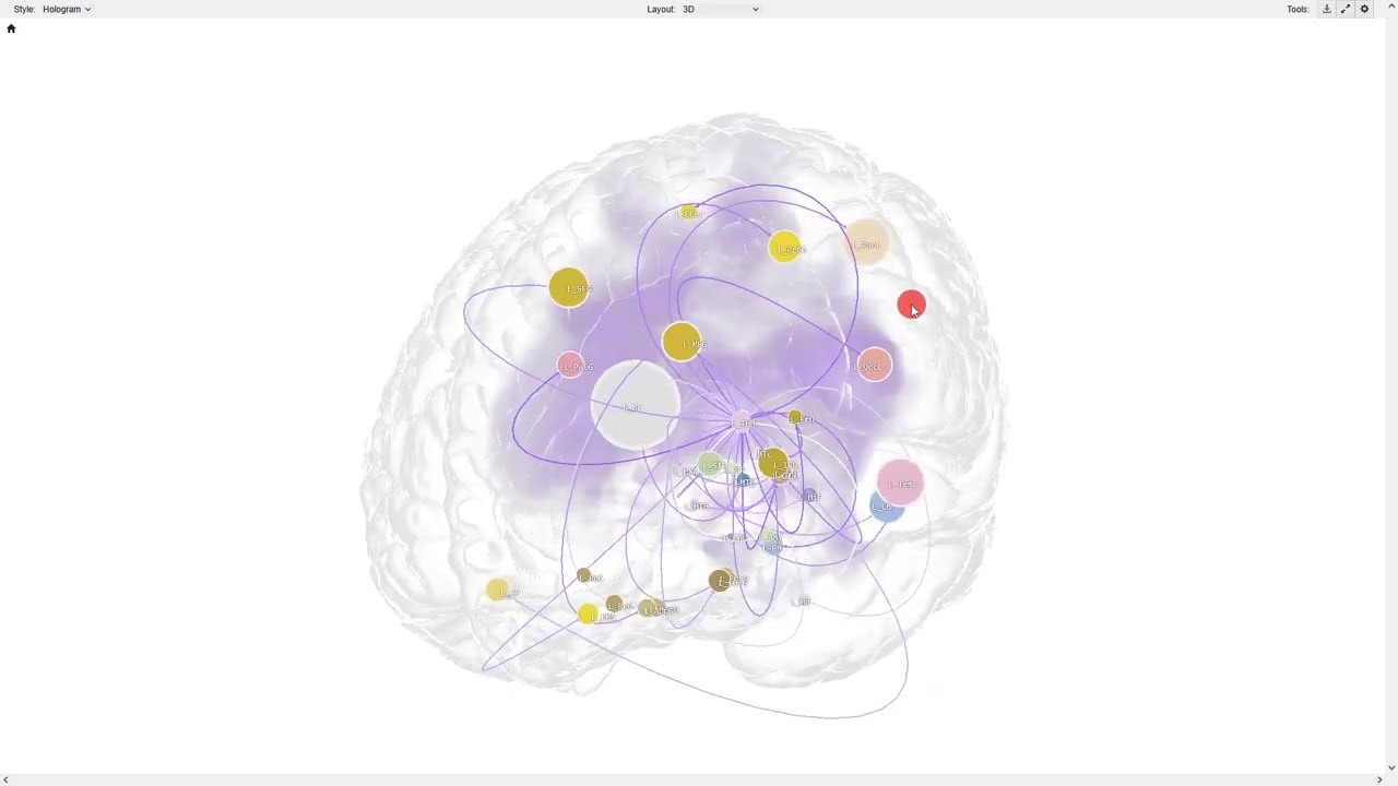 Crafting good-looking visualizations using BrainTrawler
