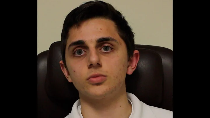 Taniel had his Keratoconus treated and is back 7 m...