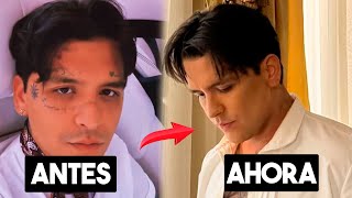 Christian Nodal Por Fin Se Borra Los Tatuajes De La Cara 😱