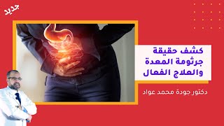 كشف حقيقة جرثومة المعدة والعلاج الفعال - دكتور جودة محمد عواد