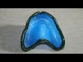 Border Molding for Complete Dentures