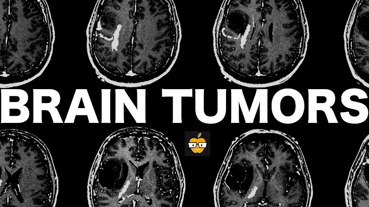 Brain Tumors