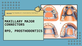Maxillary Major Connectors | Removable Partial Denture | Prosthodontics