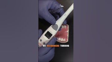 Using Loop with Contact Former