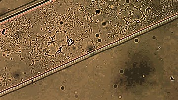 Bacterial chemotaxis