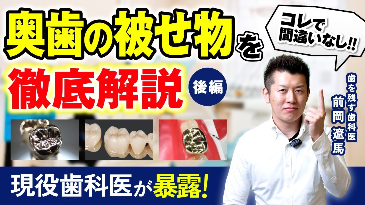 【もう迷わない！奥歯の被せ物をプロ目線で徹底解説(後編)】