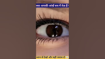 Only 1% Can Pass This Eye Test 👀 #shorts #challenge