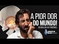 A PIOR DOR DO MUNDO? Neuralgia do Trigêmeo