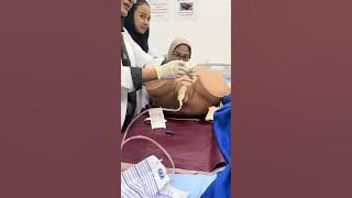 pemasangan kateter kondom