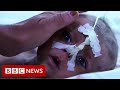 Afghan baby girl sold for $500 by starving family - BBC News