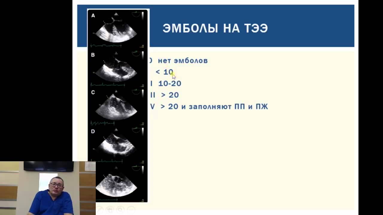 17.03.2015. Осложнения при гистероскопии. Штабницкий А М