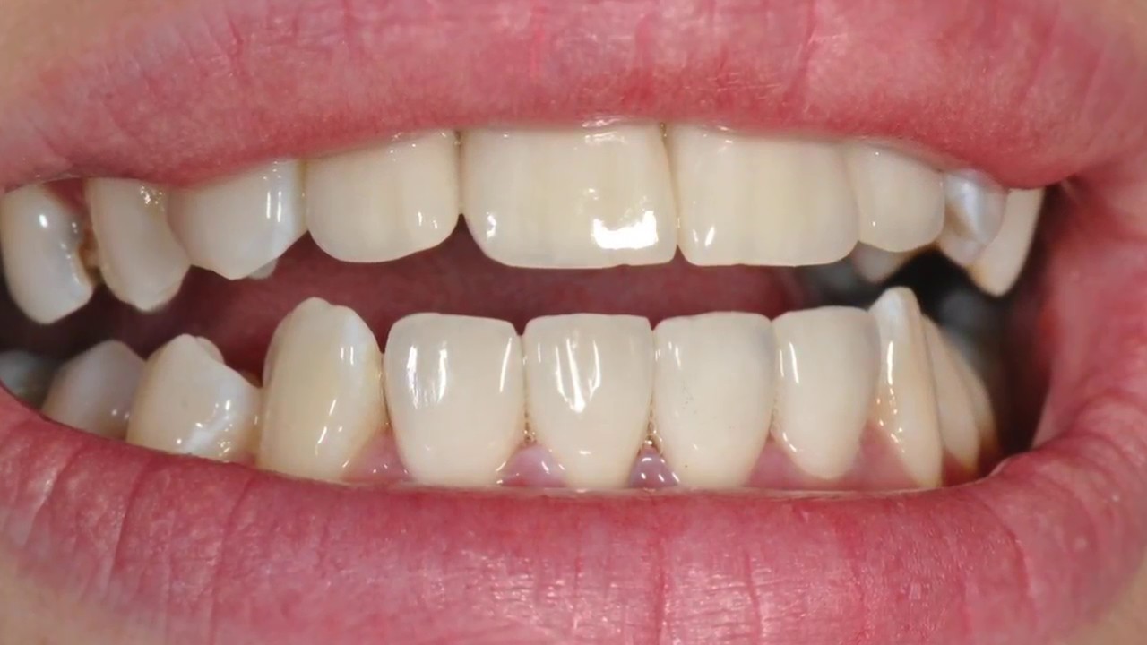 Získejte sebevědomí