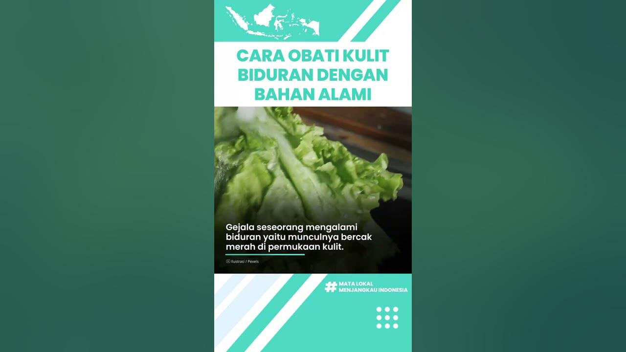 Cara Mudah Obati Kulit Biduran dengan Bahan Alami, Termasuk Air Kelapa hingga Bawang Putih Cara Mudah Obati Kulit Biduran dengan Bahan Alami, Termasuk Air Kelapa hingga Bawang Putih