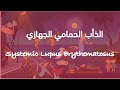 الذأب الحمامي الجهازي Systemic Lupus Erythematosus 