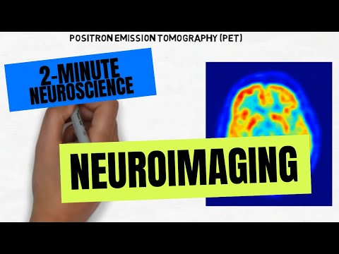 2-Minute Neuroscience: Neuroimaging