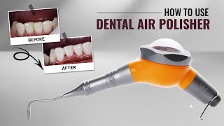 How to use Dental Air Polisher | Waldent Premium Air Polisher screenshot 3