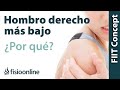 ¿Por qué muchas personas tienen el hombro derecho más bajo?